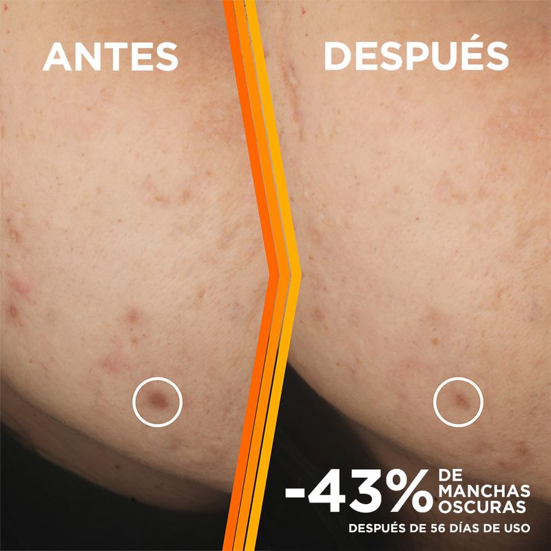 Serum-Skin-Active-Anti-Manchas-Vit-C