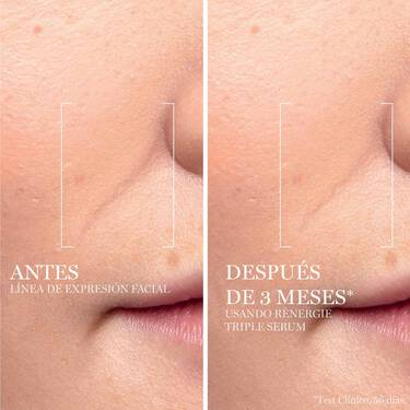 Triple-Serum-Renergie-