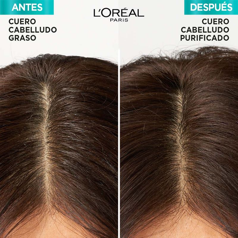 Mascara-Capilar-Hialuronico-Pure-Con-Acido-Salicilico